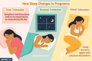 How Sleep Changes During Pregnancy